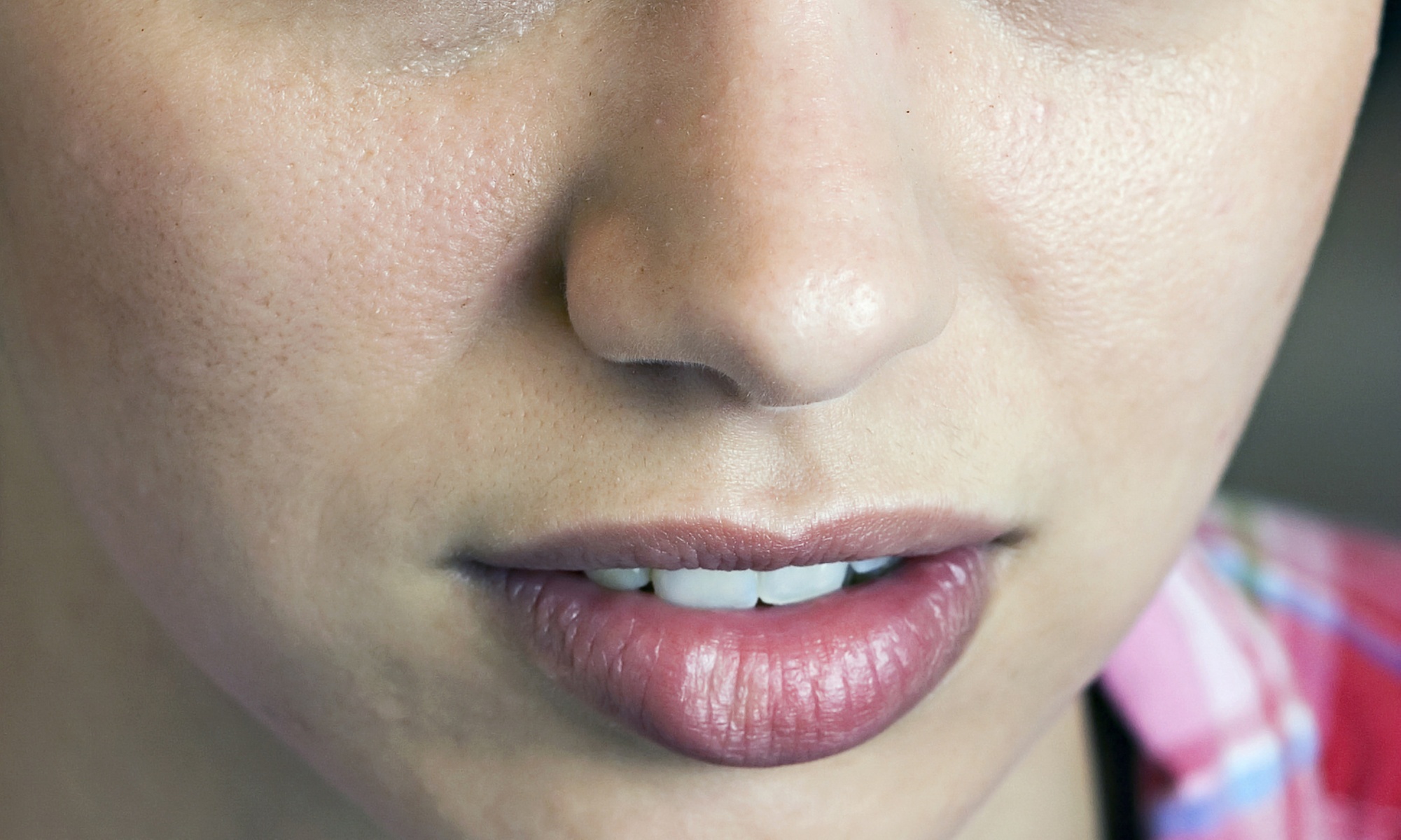 Needle-Free Hyaluronic Pen Lip Enhancements for Voluminous Pouts (1ML, 2ML, or 3ML Options) (Up to 36% Off)