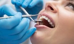 Dental checkup with cleaning, X-ray and whitening options