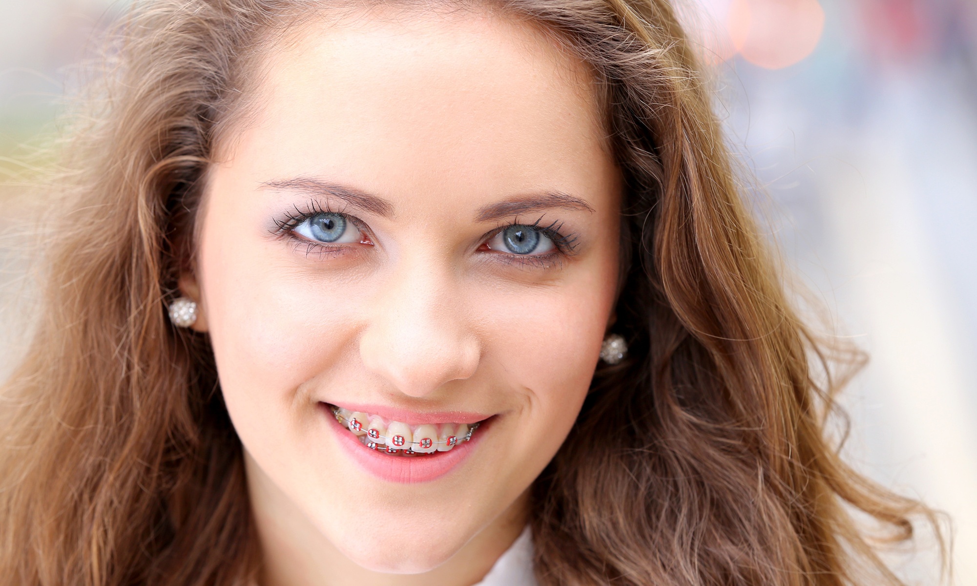 Tratamiento de ortodoncia