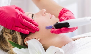 50 Min. Microneedling-Gesichtsbehandlung inkl. Hyaluron und Massage für 1 Person (50% sparen)