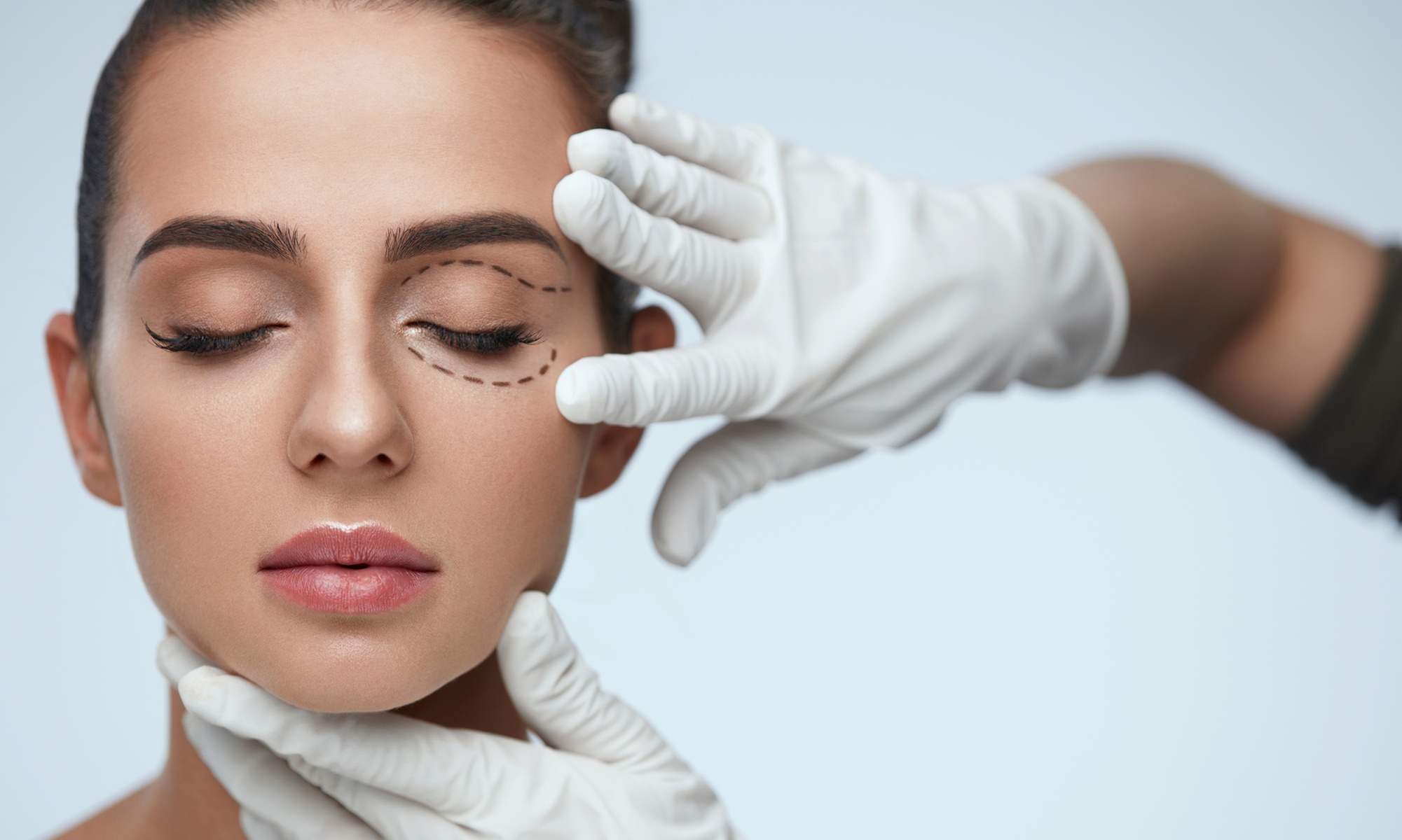 Odmładzająca radiofrekwencja mikroigłowa