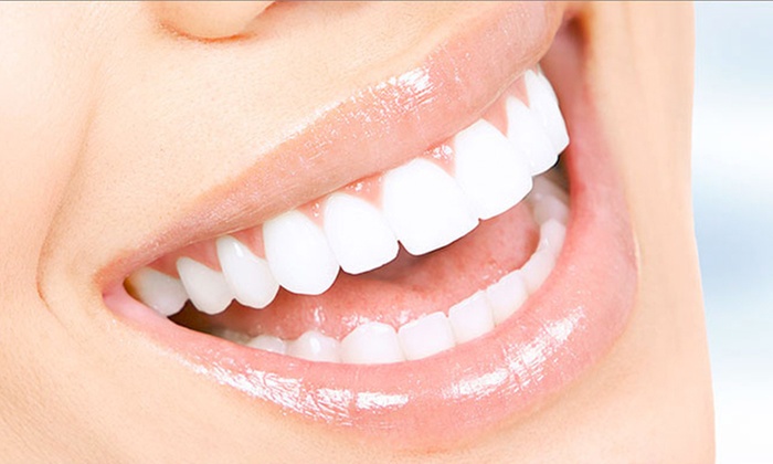 Scaling and Polishing with X-Ray at Omar Yahia Dental Surgery Clinic