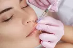 Mia Esthetics Med Spa – Botox & Lip Flip Special