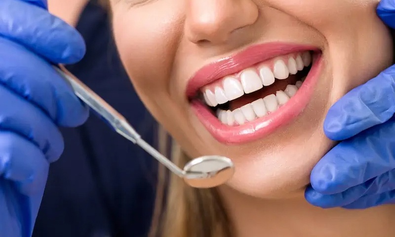 Up to 75% Off on Teeth Whitening - In-Office - Non-Branded