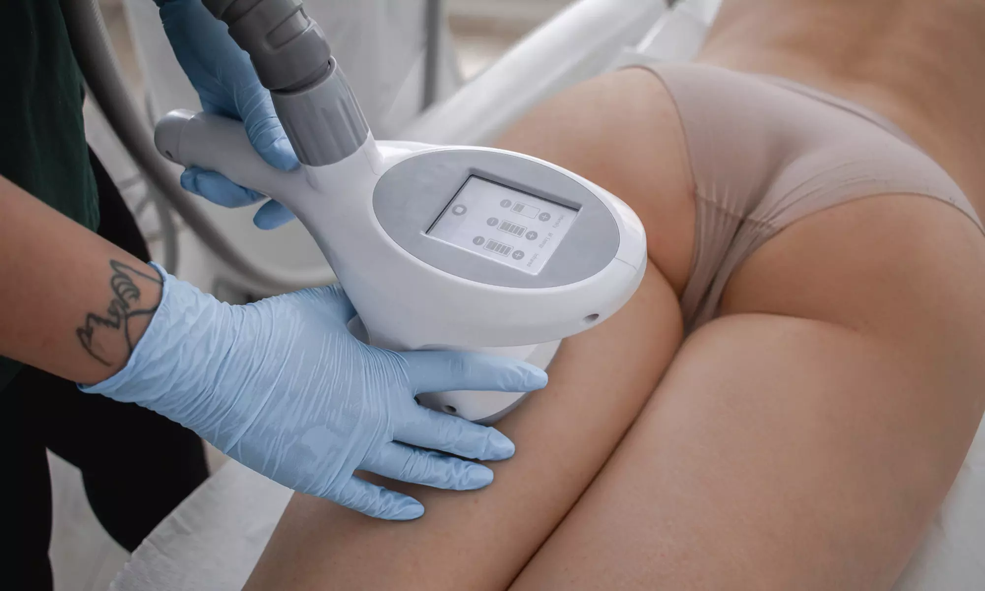 Endermologia – redukcja cellulitu i tkanki tłuszczowej: 1 lub 5 sesji