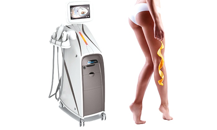 Cellulite-Behandlung mit T-Shape