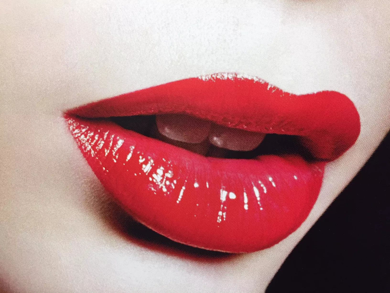 Restylane Injection for Lips or Laugh Lines