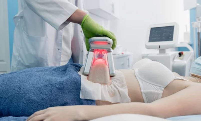 2 o 4 sesiones de criolipólisis en Adansonia Centro De Estética