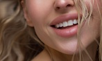 Professional Cosmetic Teeth Whitening: 30, 60 or 90-Minute Session