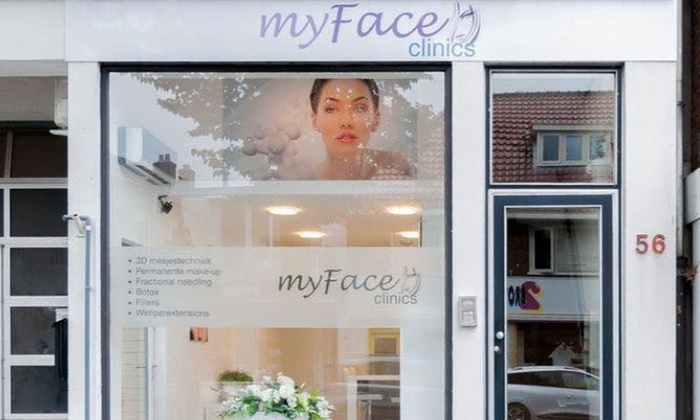 Microneedling behandeling Bussum