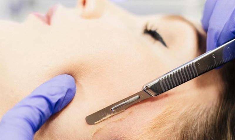 Exfoliate with Dermaplaning and Choose a Skin Boost