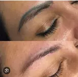 Eyebrow Tattoo Removal: Save Up to 30% Off at MB Advanced Beauty MED!