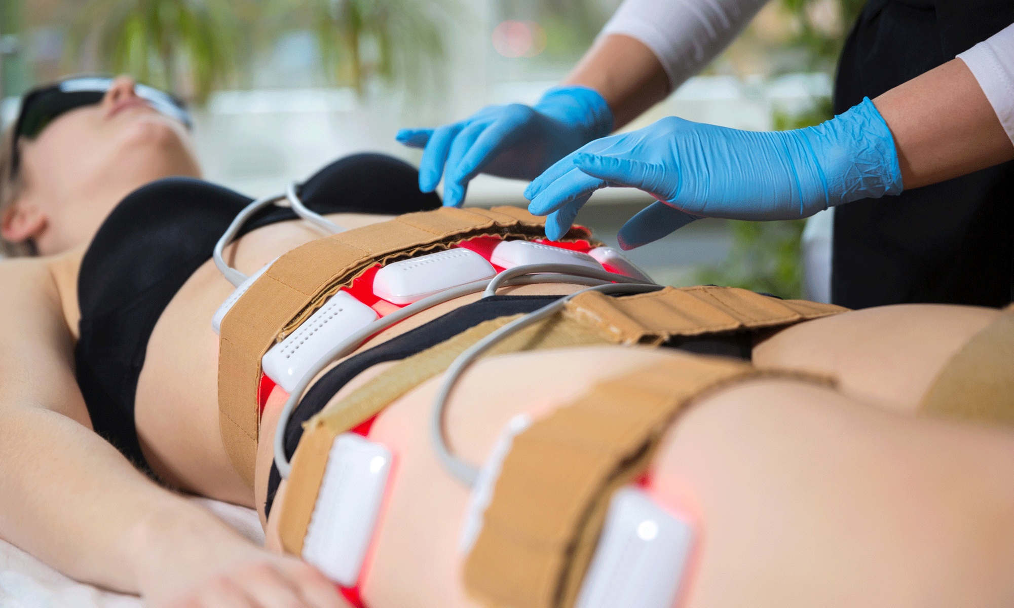 Afslank-behandeling diodelaser