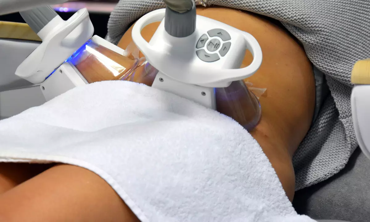 Wyszczuplająca kriolipoliza