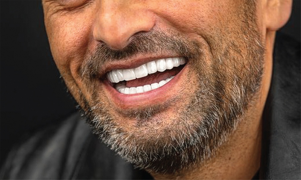 The Honest Crown Dental Implants' 1, 2, or 3 Complete Dental Implants with Abutment & Crown (Up To 36% Off)