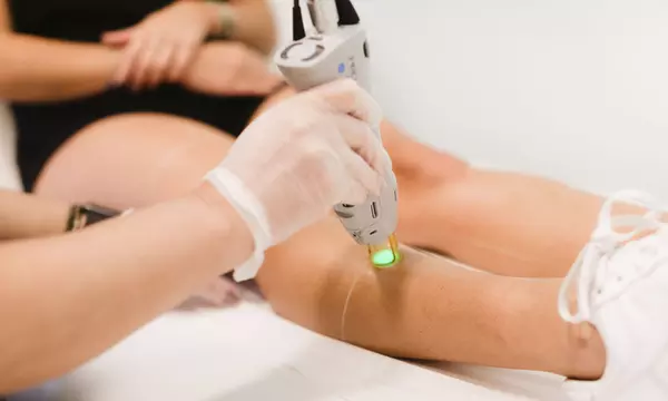 Laser Hair Removal Sessions on a Small Area at Semper Laser(Up to 93% Off) - Second Medium