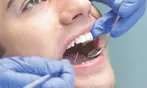 Checkup, Scale, and Polish or Teeth Whitening with In-Home Trays
