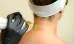 Discover Laser Hair Removal at SEV Laser, a Celebrity-Favorite Salon