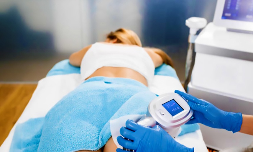 Séance cryolipolyse avec Body Industry Pantin