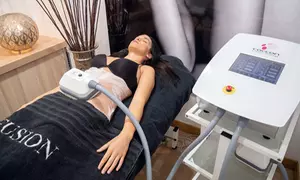 ¡Congélate en el tiempo! Combina sesiones de criolipólisis , presoterapia y masaje en Clinicas Laser Fusion Cadiz