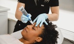 Up to 50% Off on Micro-Needling at Fine Arts of Esthiology