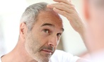 PRP Hair Restoration at Skinovatio Arlington Heights