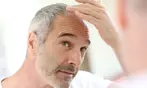 PRP Hair Restoration at Skinovatio Arlington Heights