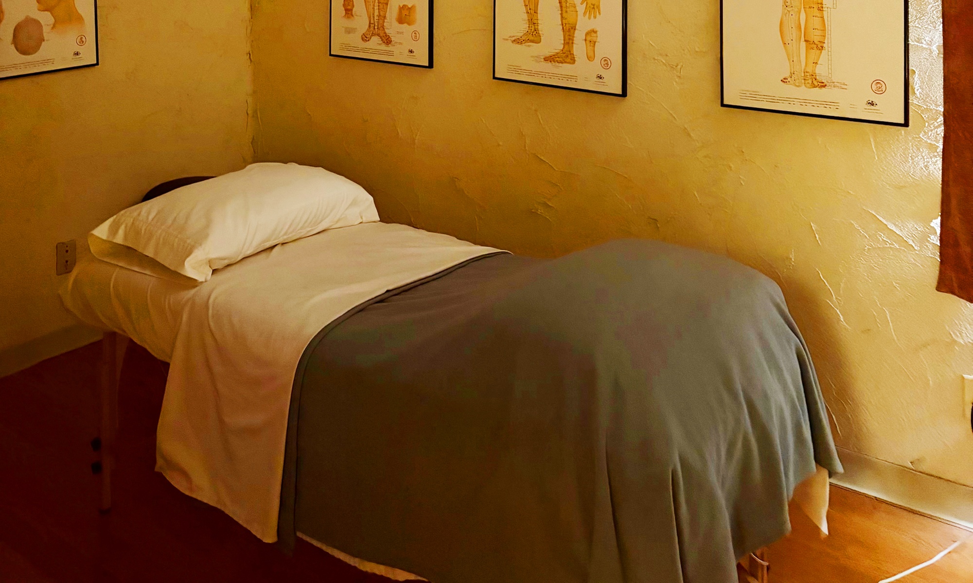 Feel Relaxed with a Single Acupuncture Session