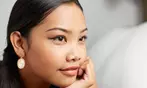 20 Units of Botox Injections at Total Med Solutions