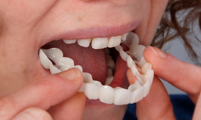 Cosmetic Dentistry Consultation