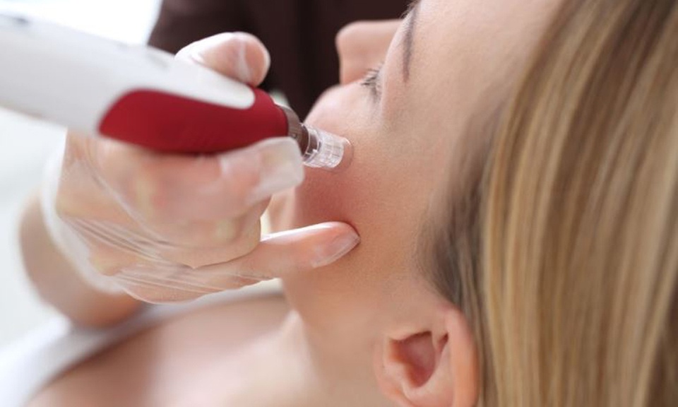 3, 6 o 9 sesiones de tratamiento facial a elegir en The Look Madrid