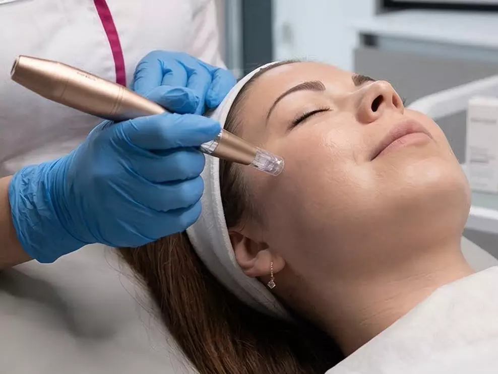 60 Min. Diamant-Mikrodermabrasion oder Microneedling für 1 Person