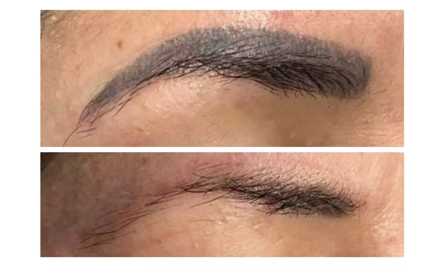 Eyebrow Tattoo Removal & Powder Brow Combo at Diane's Permanent Makeup