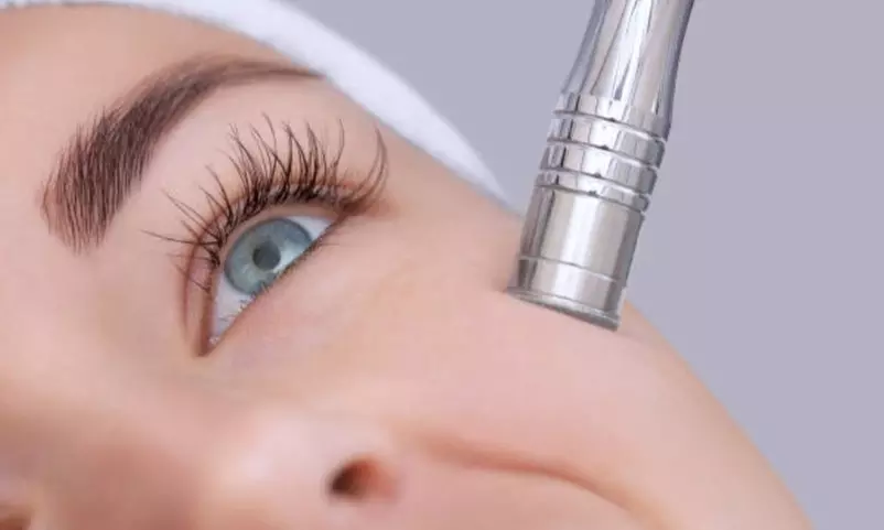 Higiene facial con opción a microdermoabrasión y radiofrecuencia