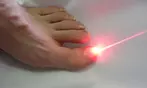 Up to 2 Sessions of Laser Nail-Fungus Removal for 1 Foot or Both Feet