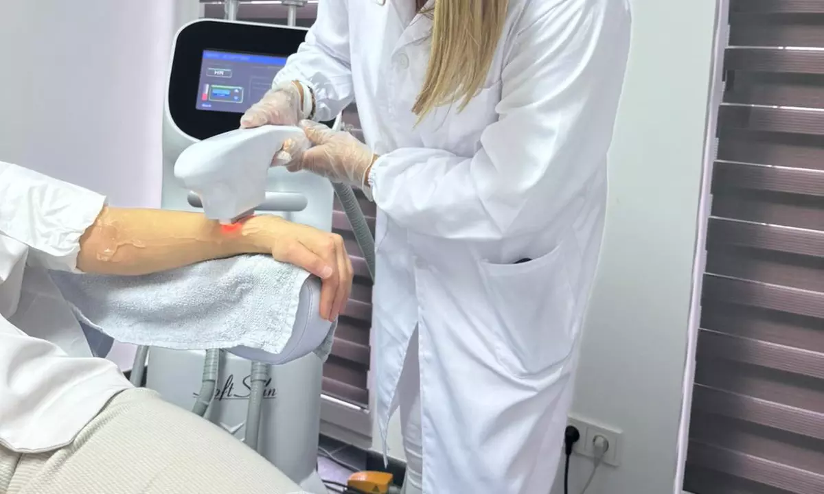 ICE Diodenlaser-Haarentfernung an 1 kleinen oder großen Zone nach Wahl