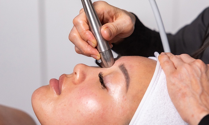 Glycolic Peel or Facial Pamper Package at Carness Hill or Campbelltown