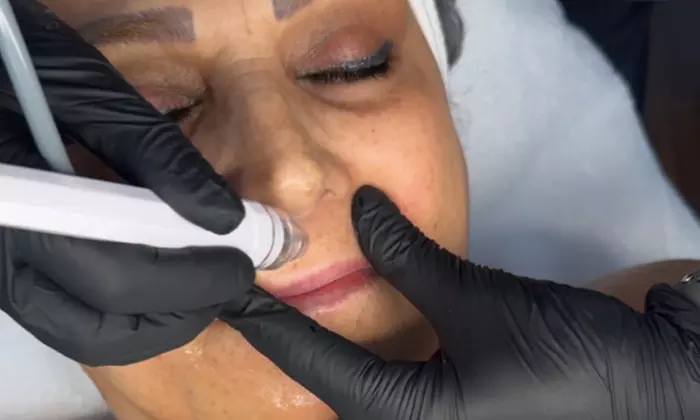 New Client Glow HydraFacial at Maily Skin Clinic