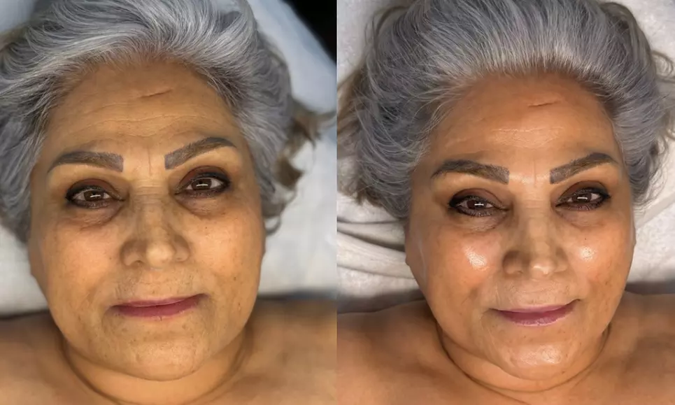 New Client Glow HydraFacial at Maily Skin Clinic