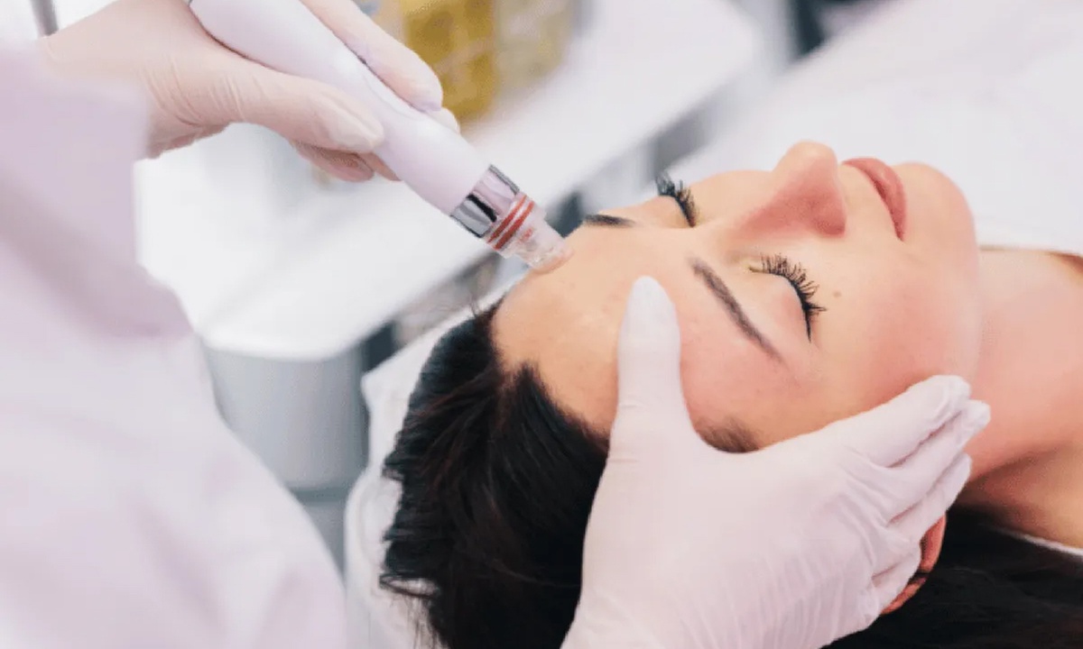 Non-Surgical Face & Body Lift