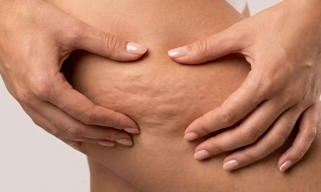 3 o 6 sesiones de maderoterapia o masaje drenante de 30 minutos