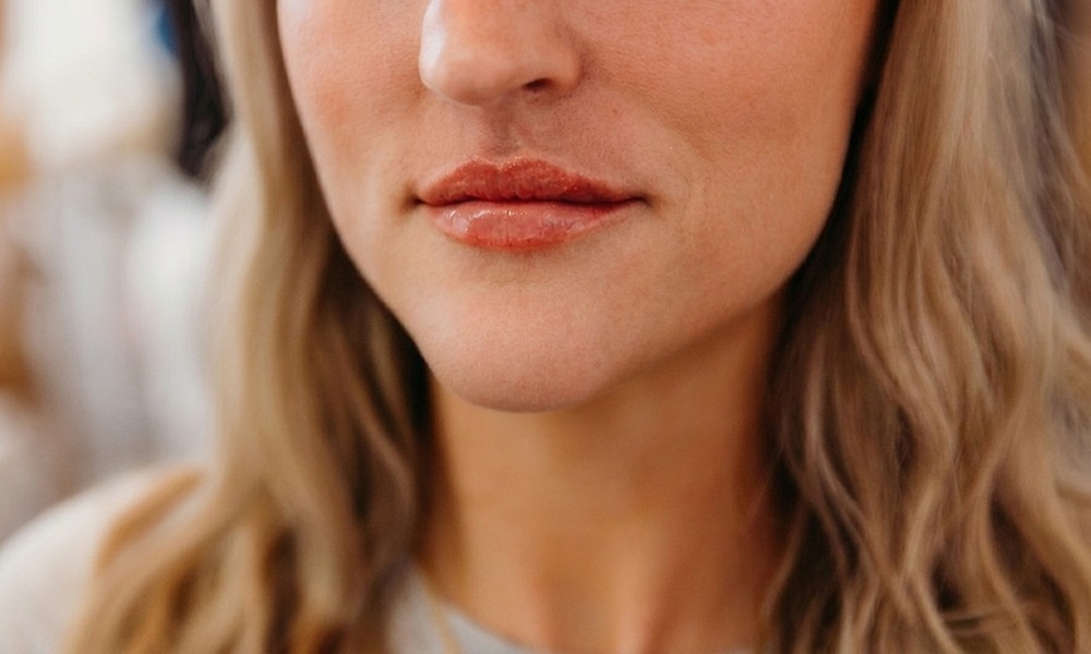 Up to 24% Off on Injection - Dermal Filler at True Aesthetic Clinic