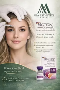 Mia Esthetics Med Spa – Botox & Lip Flip Special