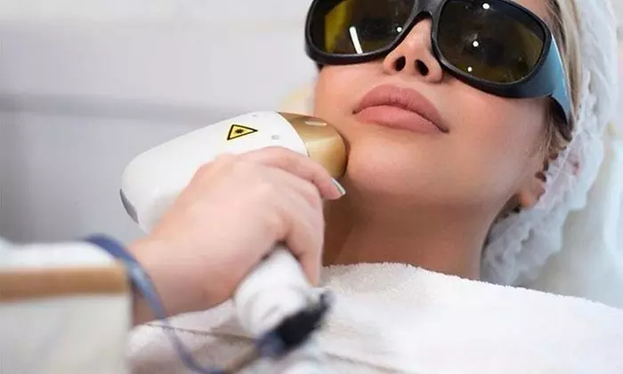 3 - 6 Behandlungen für eine Haarentfernung mit Diodenlaser