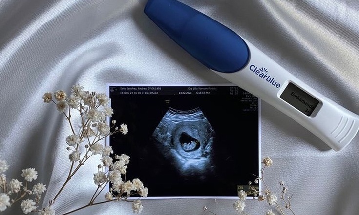 Primera ecografía 5D o pack con las 2 primeras ecografías