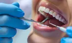 Up to 56% Off on at AJ Dental Surgery