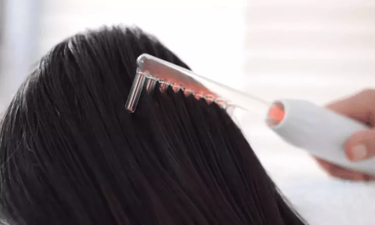 Tratamiento capilar regenerativo con alta frecuencia