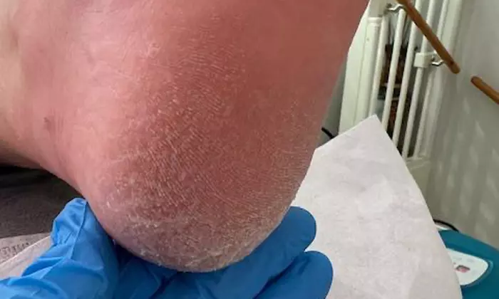 Verzorgende pedicure met ontspannende massage & verzorgde afwerking