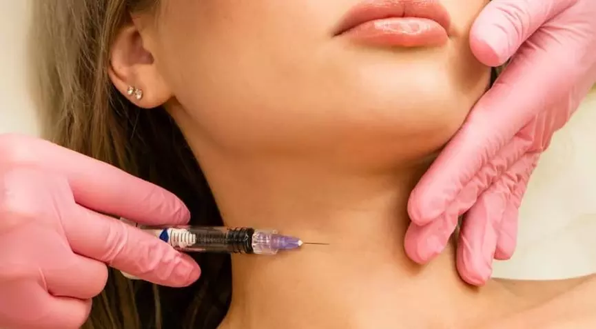 Lippenunterspritzung oder Faltenbehandlung mit Hyaluron für 1 Person