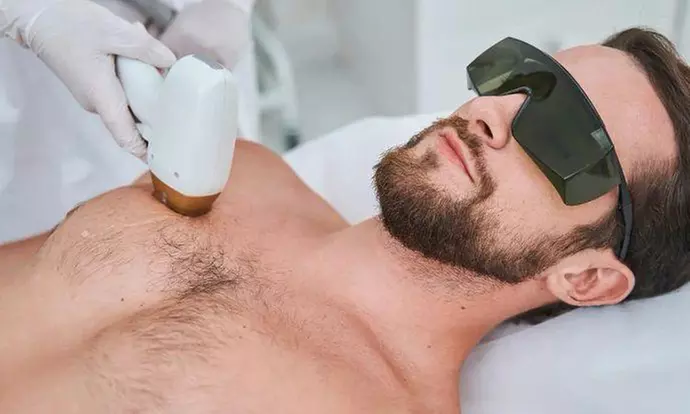 3 - 6 Behandlungen für eine Haarentfernung mit Diodenlaser